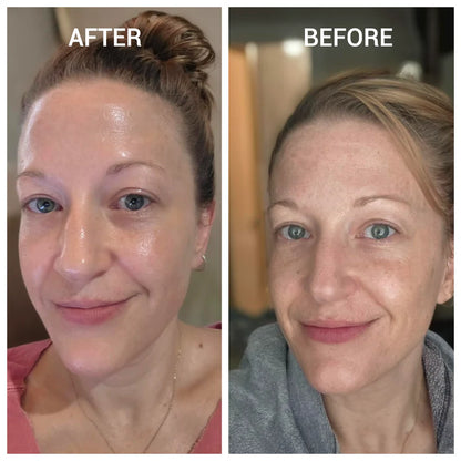 Rice Peel Glow Serum Ampoule